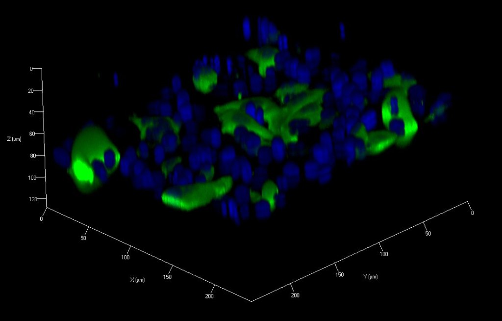 GFP-expressing PC3 prostate cancer cells migrating through an 8 micrometre pore membrane in a transwell invasion assay